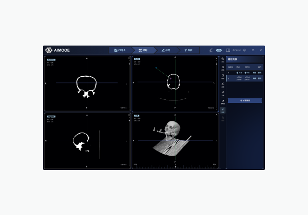 手术规划-1.png